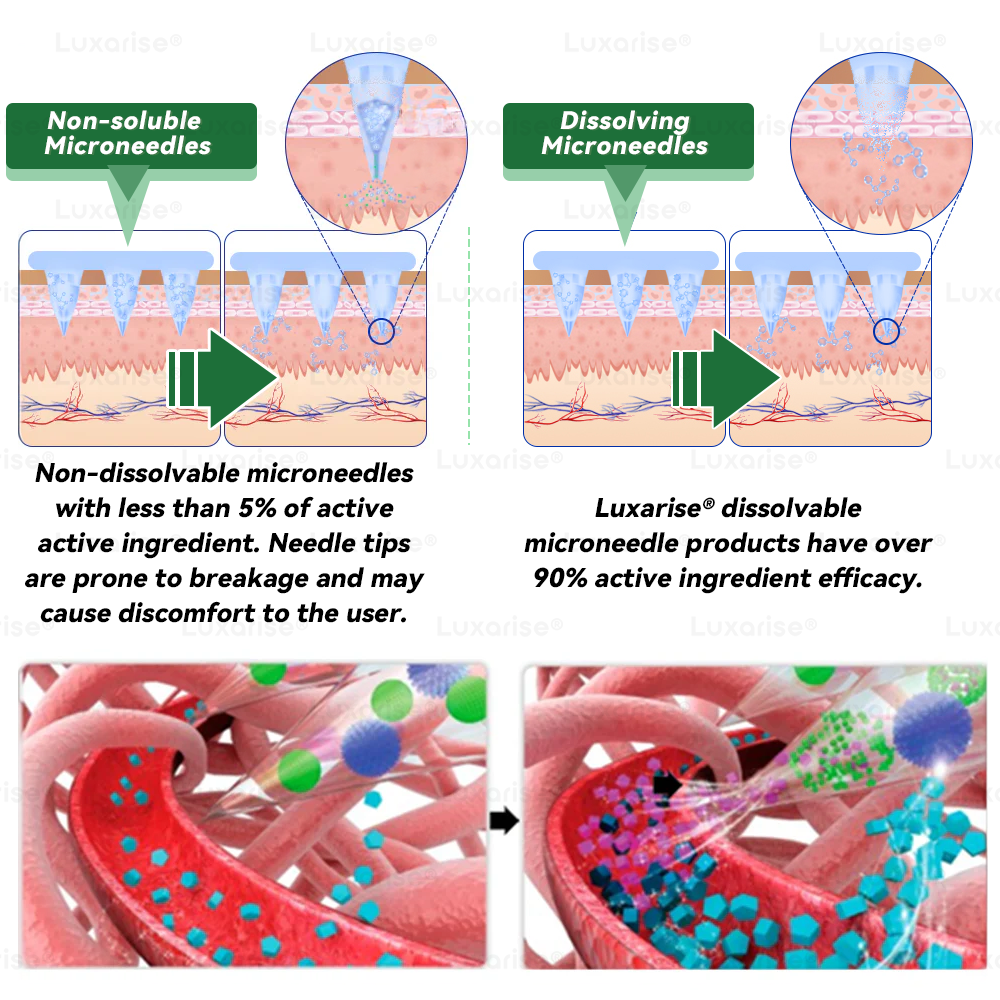 🎉New Year Special Offers 👨‍🔬 𝑳𝒖𝒙𝒂𝒓𝒊𝒔𝒆® 𝑴𝒐𝒓𝒊𝒏𝒈𝒂 & 𝑩𝒆𝒓𝒃𝒆𝒓𝒊𝒏𝒆 10-𝑰𝑵-1 𝑨𝒅𝒗𝒂𝒏𝒄𝒆𝒅 𝑵𝒂𝒏𝒐 𝑴𝒊𝒄𝒓𝒐𝒏𝒆𝒆𝒅𝒍𝒆 𝑷𝒂𝒕𝒄𝒉 🎉