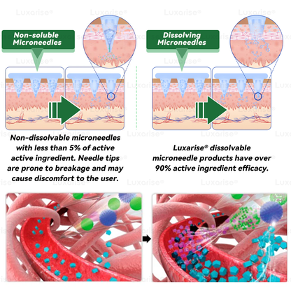 🎉New Year Special Offers 👨‍🔬 𝑳𝒖𝒙𝒂𝒓𝒊𝒔𝒆® 𝑴𝒐𝒓𝒊𝒏𝒈𝒂 & 𝑩𝒆𝒓𝒃𝒆𝒓𝒊𝒏𝒆 10-𝑰𝑵-1 𝑨𝒅𝒗𝒂𝒏𝒄𝒆𝒅 𝑵𝒂𝒏𝒐 𝑴𝒊𝒄𝒓𝒐𝒏𝒆𝒆𝒅𝒍𝒆 𝑷𝒂𝒕𝒄𝒉 🎉
